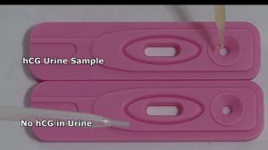putting urine sample in kit